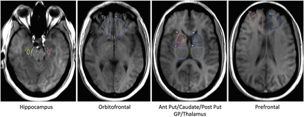 Fig 1.