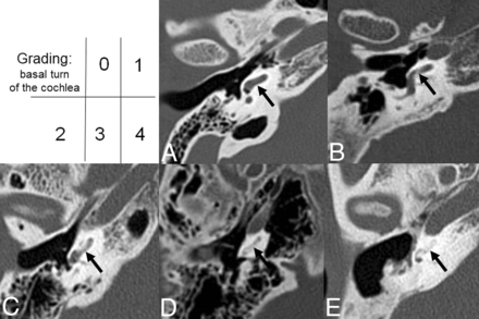 Fig 1.