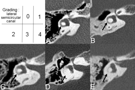 Fig 2.