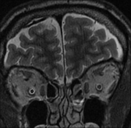 Fig 1.