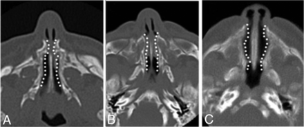 Fig 3.