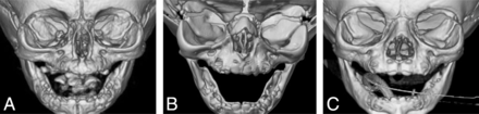 Fig 4.