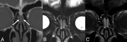 Fig 1.