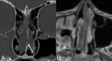 Fig 10.