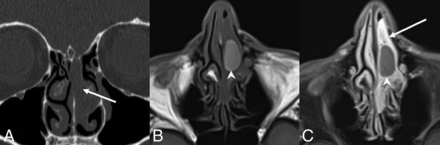 Fig 2.