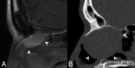 Fig 3.