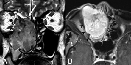 Fig 5.