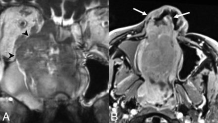Fig 6.