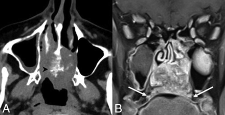 Fig 7.