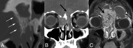 Fig 8.