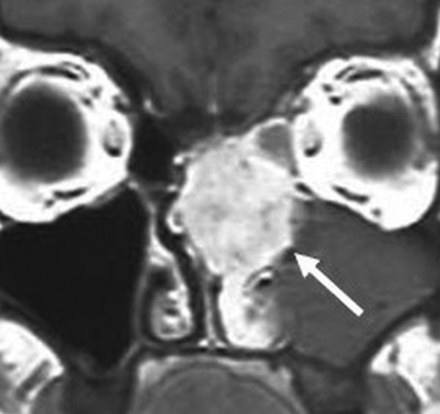 Fig 9.