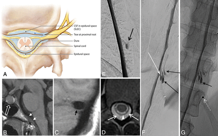 Fig 3.