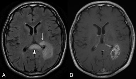 Fig 4.