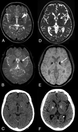 Fig 2.
