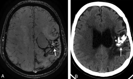 Fig 5.