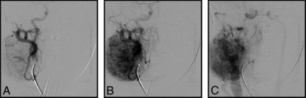 Fig 2.