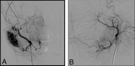 Fig 3.