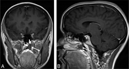 Fig 3.