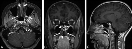 Fig 4.