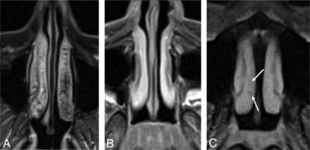Fig 5.