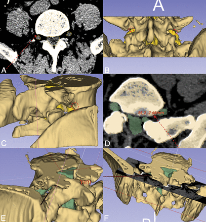 Fig 6.