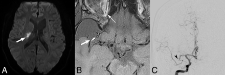 Fig 2.