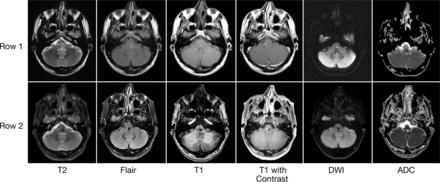 Fig 2.