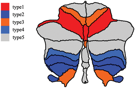 FIGURE.
