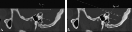 Fig 2.