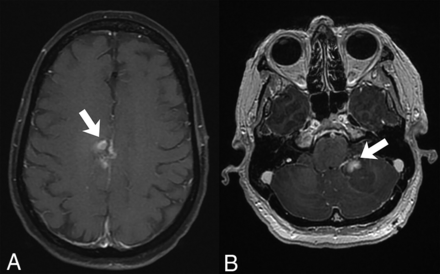 Fig 3.