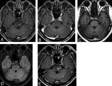 Fig 1.