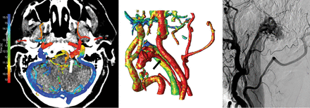 Fig 4.