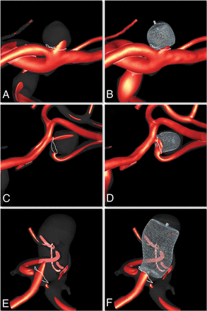 Fig 1.