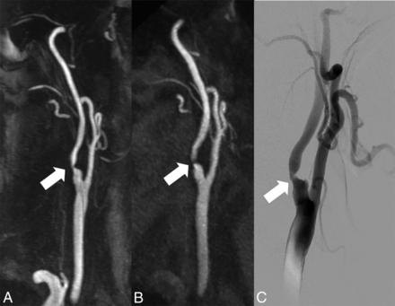 Fig 5.