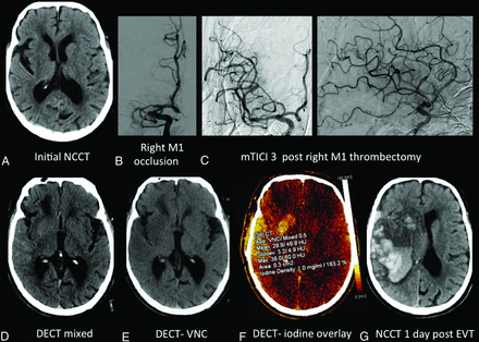 Fig 3.