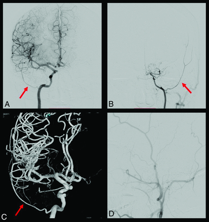 FIG 3.
