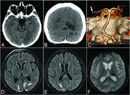 FIG 1.