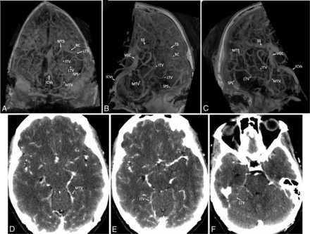 FIG 1.