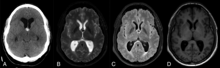 FIG 4.