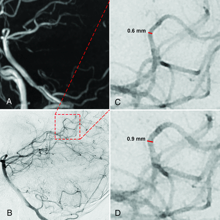 FIG 2.