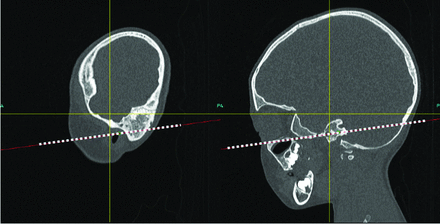 FIG 1.