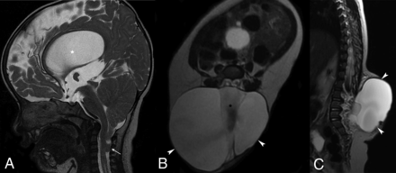 FIG 3.
