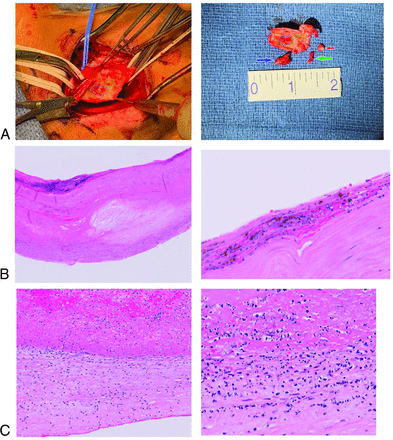 FIG 2.