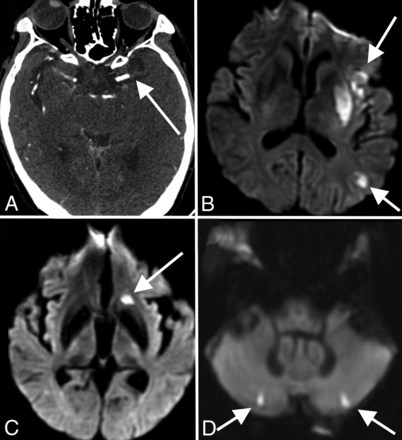 FIG 1.