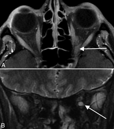 FIG 4.