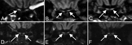 FIG 5.