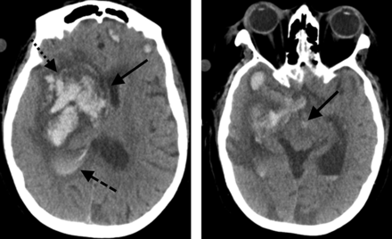FIG 1.