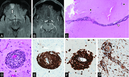 FIG 2.