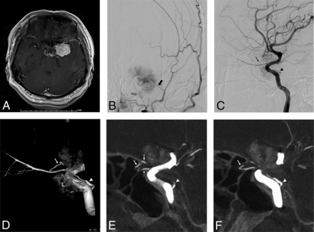 FIG 3.