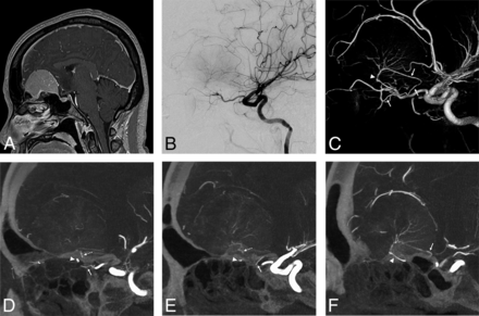 FIG 4.